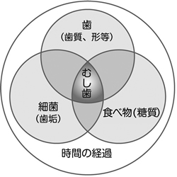 虫歯の原因と予防