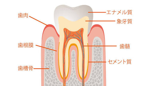 虫歯の進み方