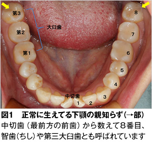 親知らず