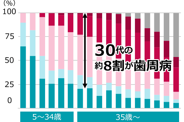 歯周病とは