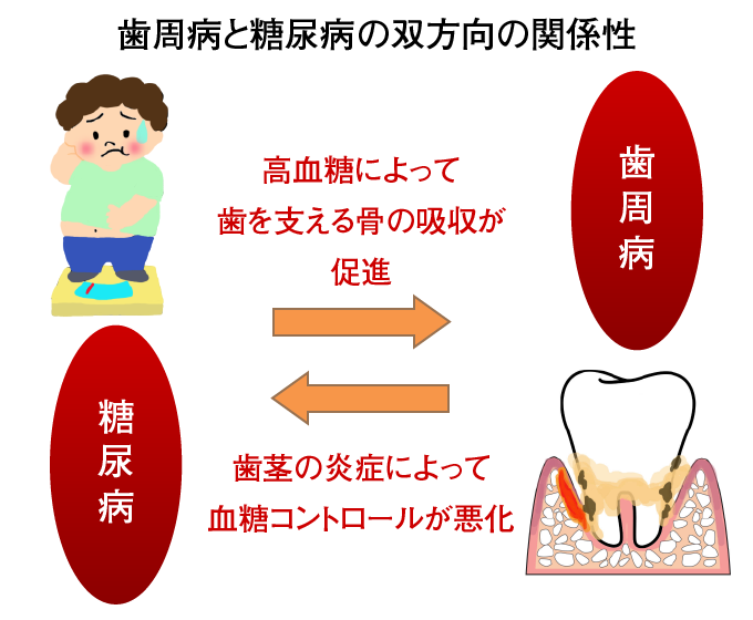 歯周病と糖尿病