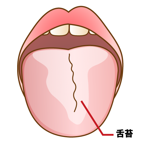 舌苔の話