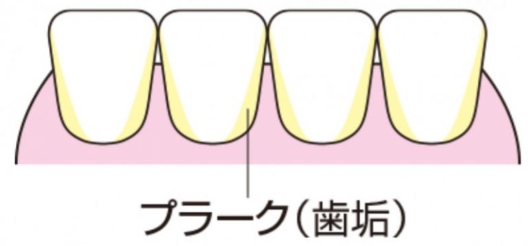 デンタルフロスの使い方