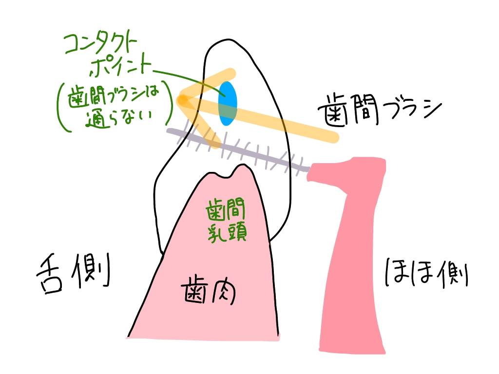 歯間ブラシの使い方