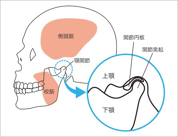 顎関節症