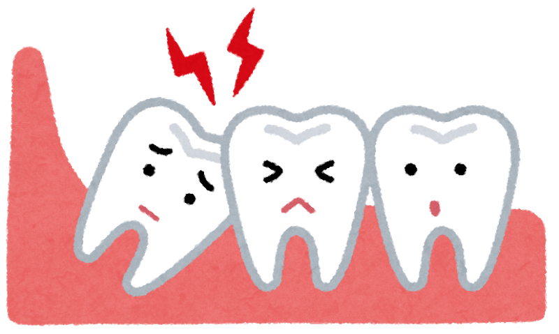 親知らず、抜いた方が良いですか？