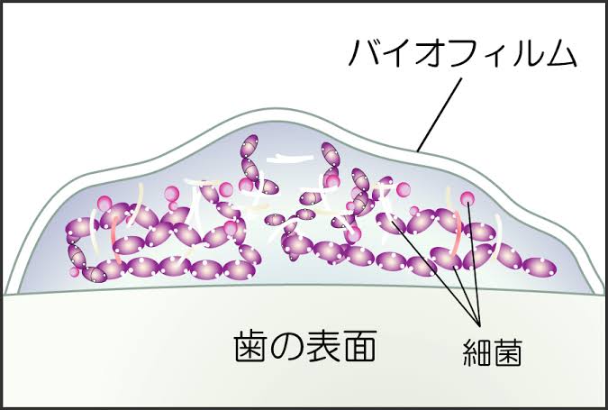 歯に触れずに歯が綺麗になる？