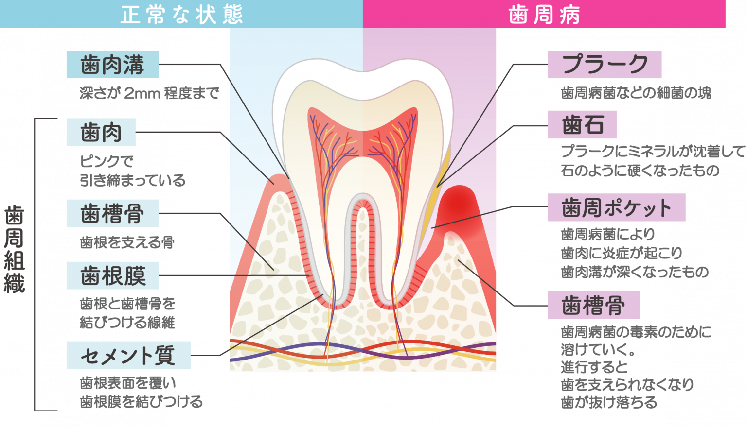 歯周病セルフチェックリスト