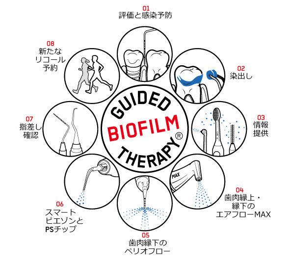 歯周病の原因って実は