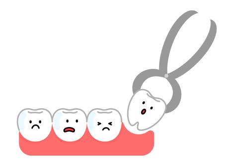 虫歯について🦷