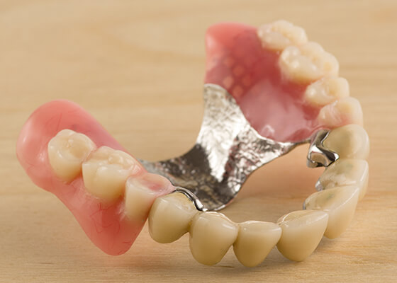 入れ歯治療 Denture