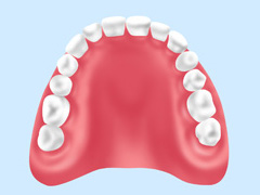 レジン床義歯（保険診療）