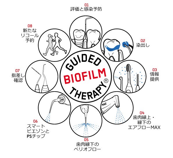 Guided Biofilm Therapy(GBT)の治療目的
